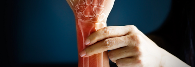 6 Exercises to Help Arthritis